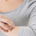 Cara Mencegah Infeksi Jamur pada Kulit dan Tubuh